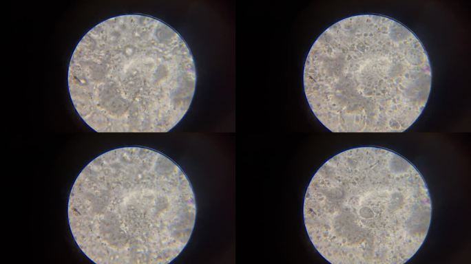 显微镜下精子运动4