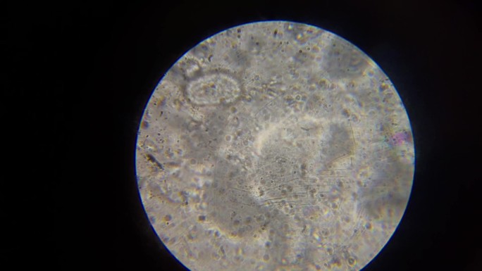 显微镜下精子运动3