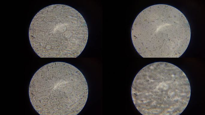 显微镜下精子运动1