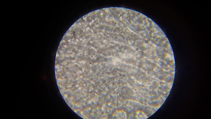 显微镜下精子运动