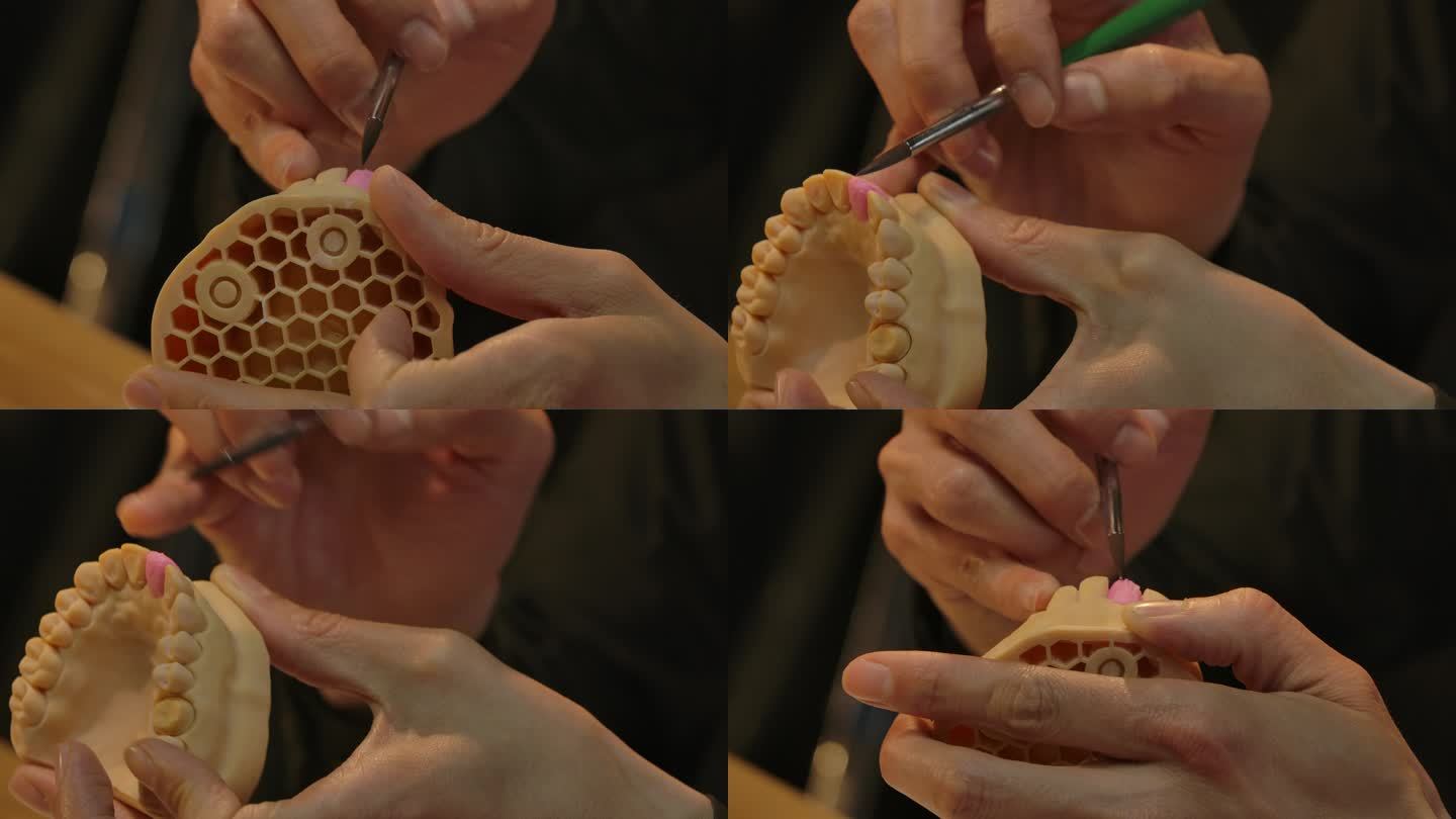 牙齿制作过程假牙义齿