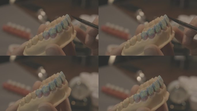 牙齿制作过程假牙义齿口腔