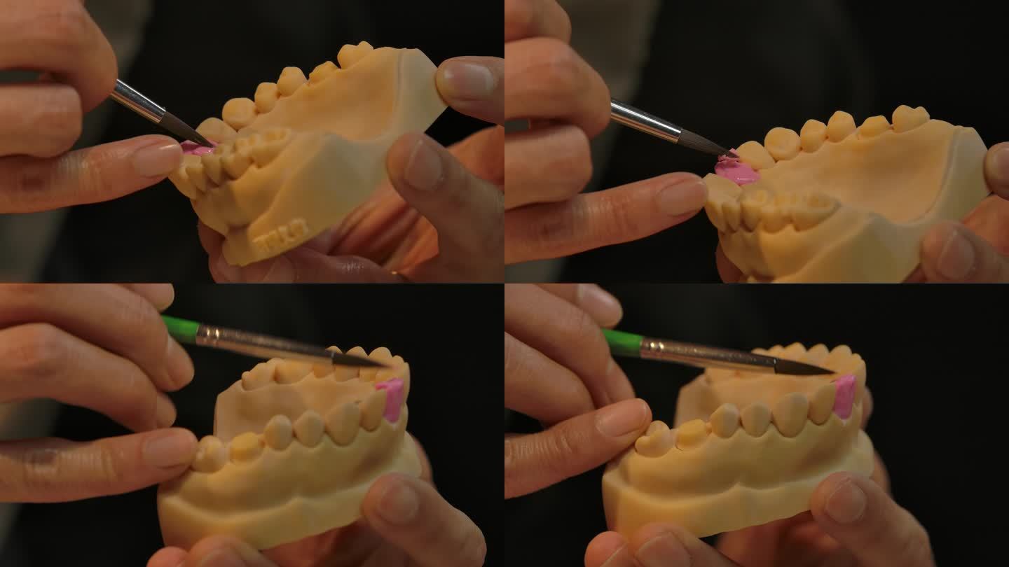 牙齿制作过程假牙义齿