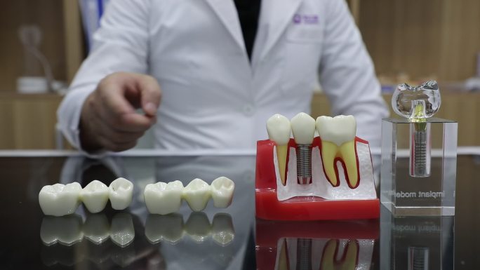 口腔 医疗 种植体 牙冠  牙模展示