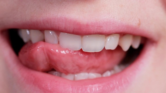 一个男人笑的宏观视频,显示出了舌尖的牙齿.切割机的牙齿在咬种子壳和固体食物时的效果。牙医、牙科诊所