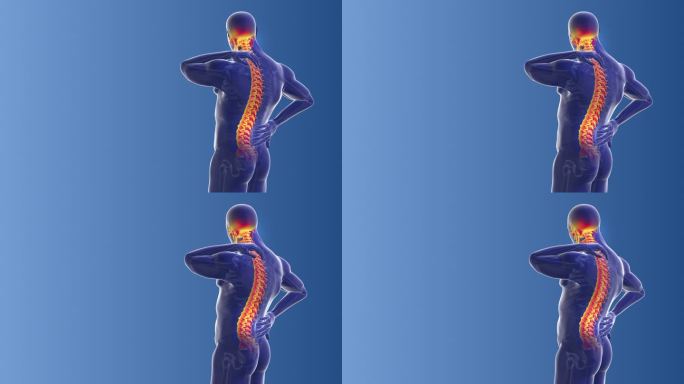 颈背痛的医学概念