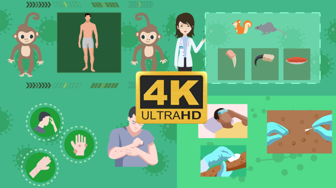 原创二维4k猴痘动画无字幕模板