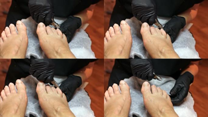 修脚师傅用钢丝钳在护理过程中给指甲塑形