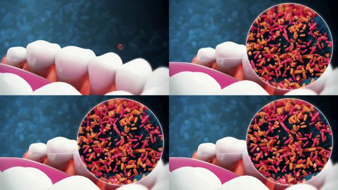 牙齿周围有细菌或病毒