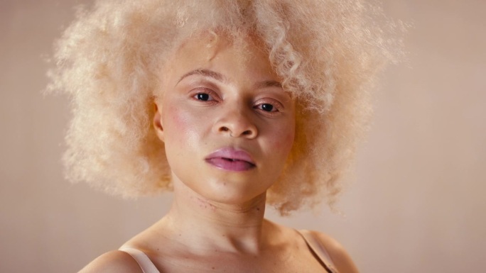 工作室肖像拍摄自信的自然白化病妇女在内衣促进身体的积极性