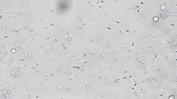 在显微镜下测试男性精液的生育能力，白色背景上有400个精子