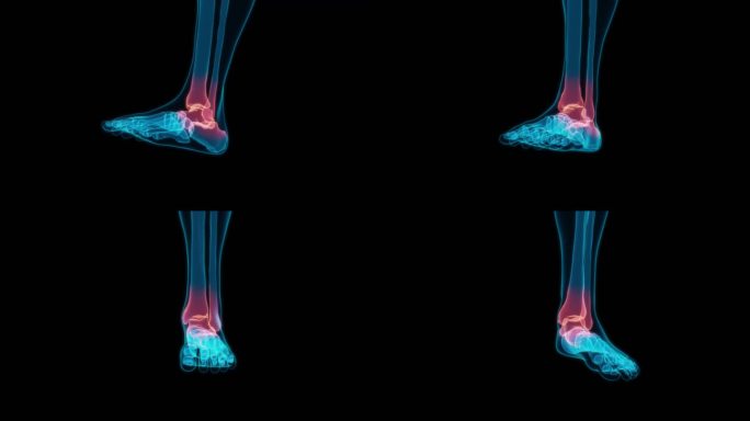 脚踝 脚腕脚掌脚后跟脚趾头足部骨折韧带
