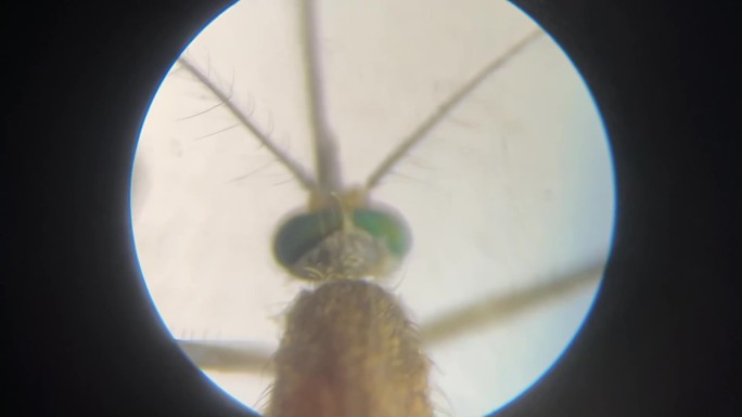 显微镜下的视角—蚊子