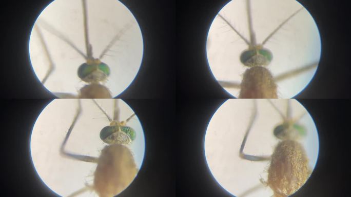显微镜下的视角—蚊子