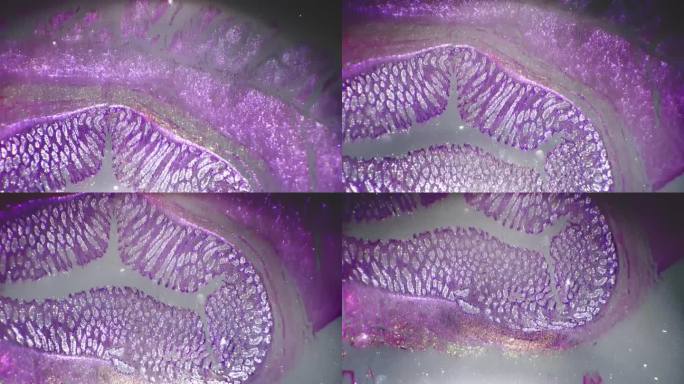 人直肠片，放大100倍，显微镜下交叉光拍摄