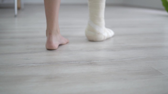 腿伤后在家中进行康复治疗，一名打石膏的脚骨折妇女试图迈出一小步