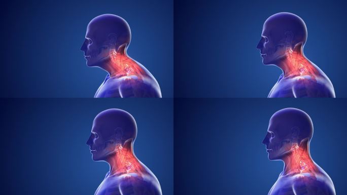 颈椎体位综合征或颈部疼痛
