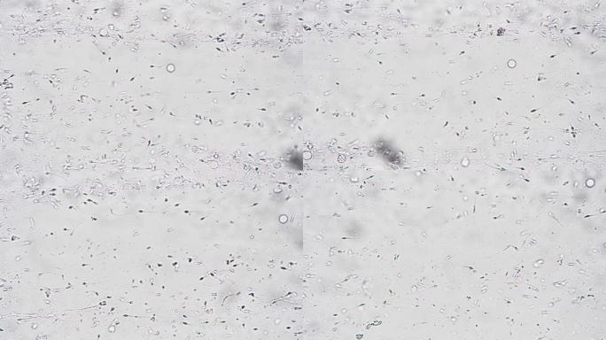 白色背景下，显微镜放大400倍，精子逆行游动