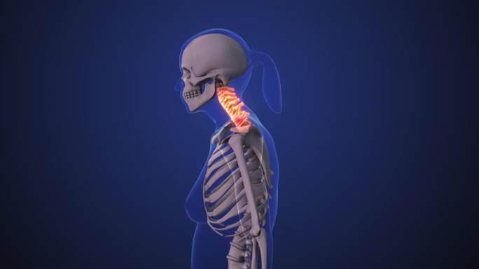 颈部疼痛或颈部功能障碍或颈椎姿势综合症