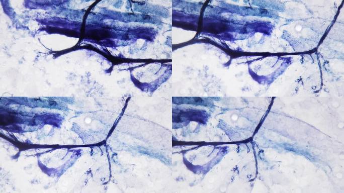 在200x显微镜下拍摄的整个人体运动神经末梢