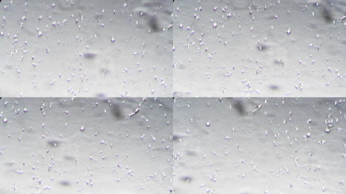 倾斜光照下显微镜放大400倍可见大量不动精子