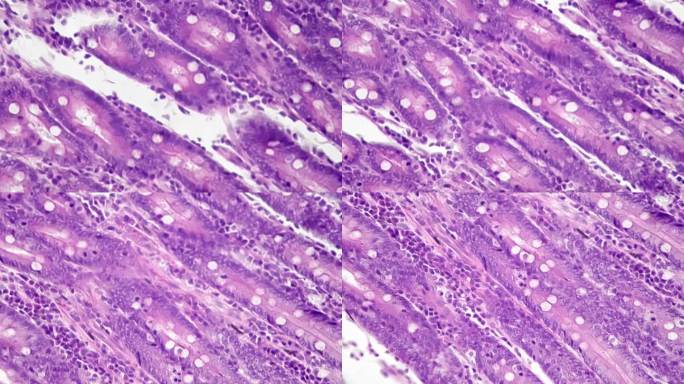 在400倍科学显微镜下拍摄的人类空肠切片