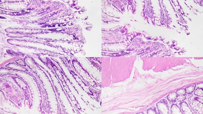 在科学实验室用100倍医学显微镜下拍摄的人体结肠切片