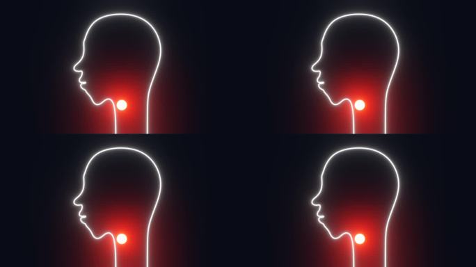 喉咙痛的概念。人类头部轮廓与红色发光急性鼻咽痛3d动画4K。扁桃体炎患者有吞咽疼痛、不适、发炎、发热