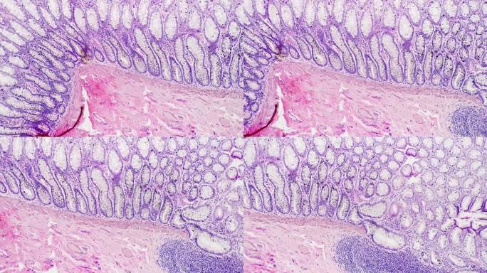 人体直肠组织在显微镜下对亮场放大100倍