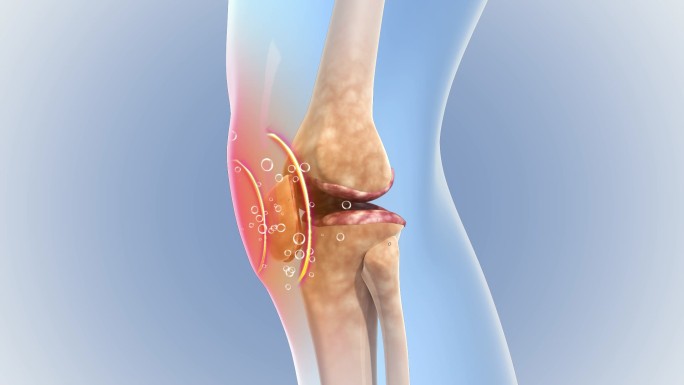 膝盖吸收药物分子恢复健康