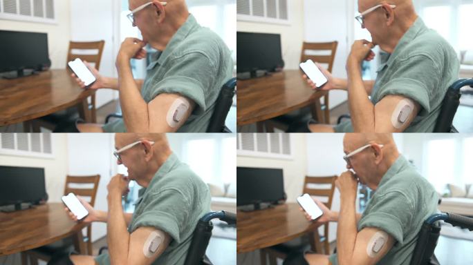 老人使用连续血糖监测仪