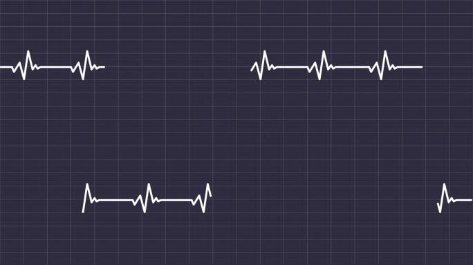 在空白背景上分离的心电图的说明性动画