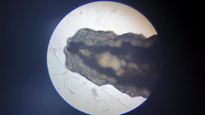 蠕虫微生物涡虫显微镜 (2)