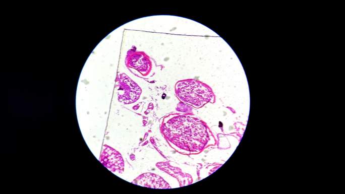 放大镜观察鱼精巢细胞 (4)