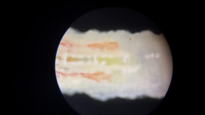 害虫涡虫放大显微镜 (2)