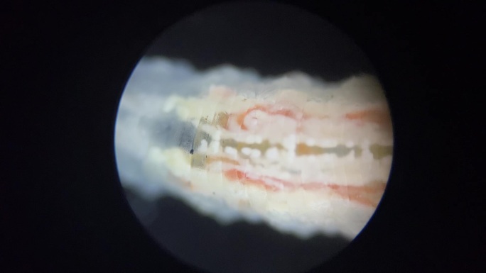 害虫涡虫放大显微镜 (3)