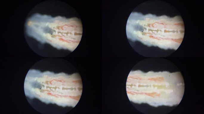 害虫涡虫放大显微镜 (3)