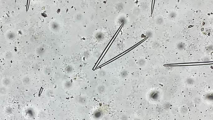 海绵骨针显微镜放大 (1)
