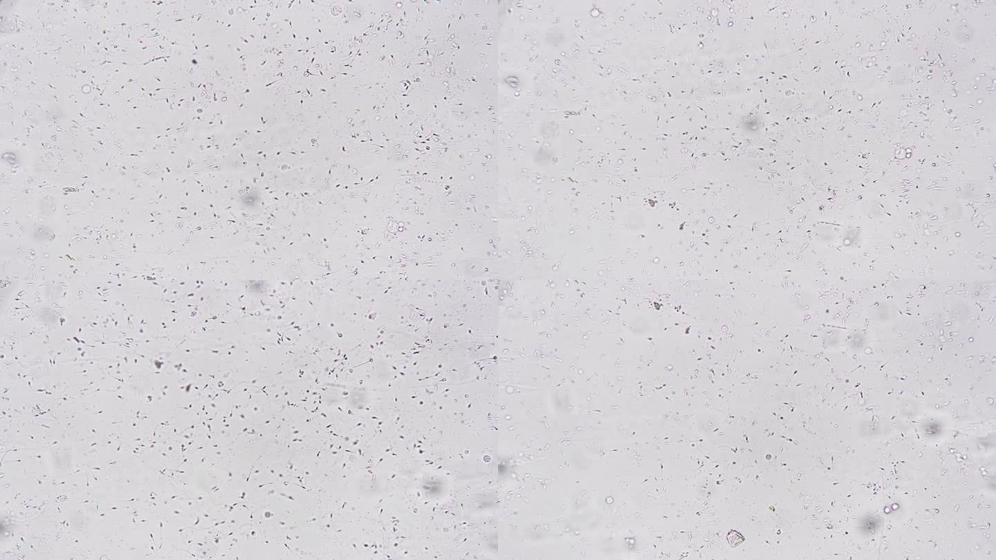 在200个精子的显微镜下检查人类精液的生物物质
