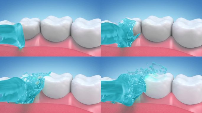 漱口水可以清洁牙龈和牙齿