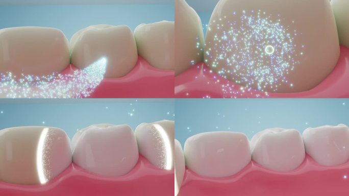 牙齿清洁产品医学模型医疗行业清除表面