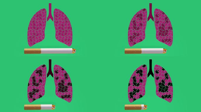 肺癌3d概念动画