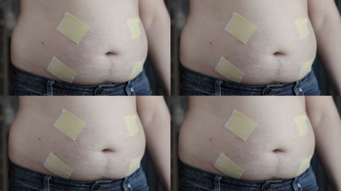 男人的肚子上贴了很多减肥用的抗脂肪组织贴片。燃烧脂肪的医用贴片。缓慢的莫
