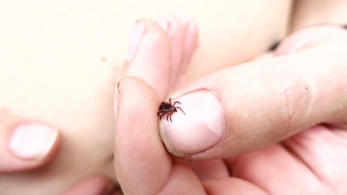 小虫寄生螨爬在一个人的手掌上。在皮肤上打勾。蜱虫携带脑炎疾病。人类皮肤上的吸血蜱虫