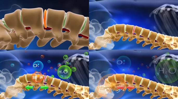 人体脊椎压迫缓解动画