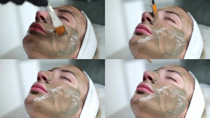 在碳皮剥离后，皮肤科医生在女孩的脸上敷上绿色的面膜。面膜使皮肤恢复活力，并在临床上刺激细胞再生的自然