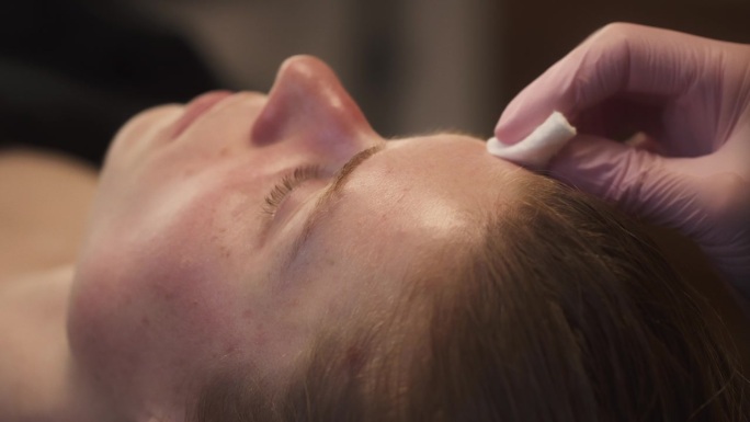针灸治疗后，美容师用化妆棉擦拭她的脸。