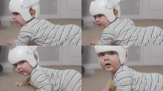 8个月大的婴儿在肚子上戴着治疗头盔看镜头
