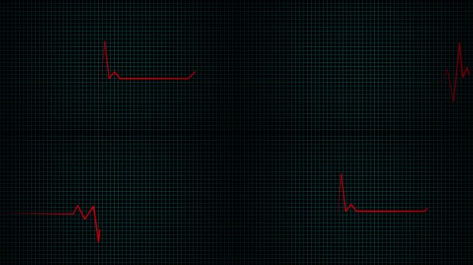 心率心电图跳动