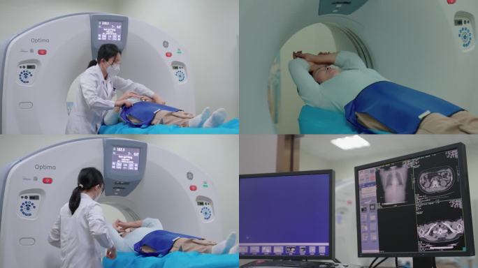 CT检查-全身检查 体检 CT扫描